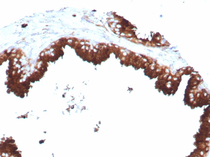 Formalin-fixed, paraffin-embedded human prostate stained with CD63 antibody (LAMP3/8770R). HIER: Tris/EDTA, pH9.0, 45min. Secondary: HRP-polymer, 30min. DAB, 5min.