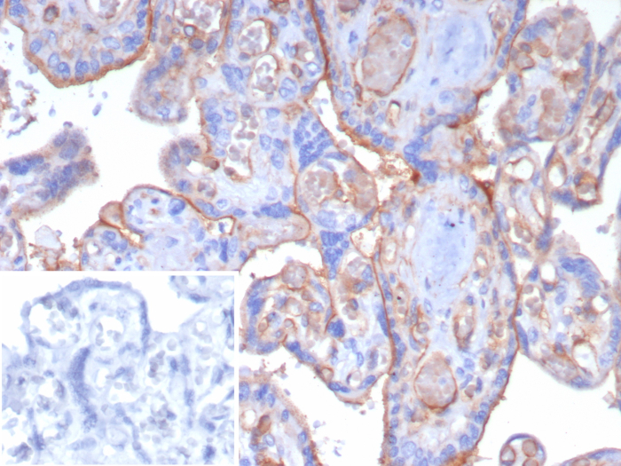 Formalin-fixed, paraffin-embedded human placenta stained with Thrombomodulin/BDCA-3 antibody (THBD/8188R). Inset: PBS instead of primary antibody; secondary only negative control.