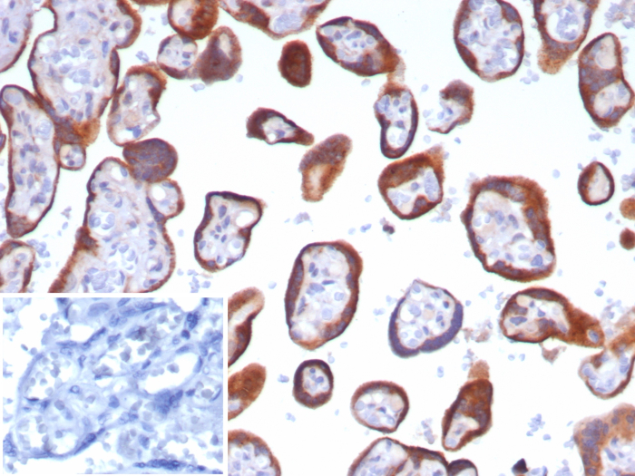 Formalin-fixed, paraffin-embedded human placenta stained with Glypican 3 antibody (GPC3/8148R). Inset: PBS instead of primary antibody; secondary only negative control.