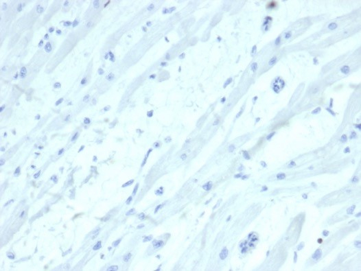 IHC analysis of formalin-fixed, paraffin-embedded human heart. Negative tissue control using SATB2 antibody (SATB2/7111) at 2ug/ml in PBS for 30min RT. HIER: Tris/EDTA, pH9.0, 45min. Secondary: HRP-polymer, 30min. DAB, 5min.