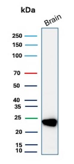 Western blot analysis of human brain tissue lysate using UCH-L1/PGP9.5 Antibody (UCHL1/8107R) - Azide and BSA Free. 