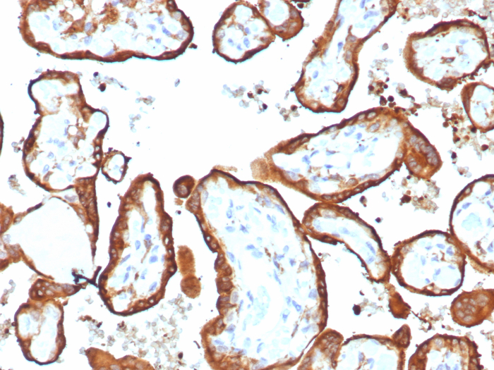 Formalin-fixed, paraffin-embedded human placenta stained with Chorionic Gonadotropin beta Chain (hCG beta) antibody (HCGa/7806R). HIER: Tris/EDTA, pH9.0, 45min. 2: HRP-polymer, 30min. DAB, 5min.