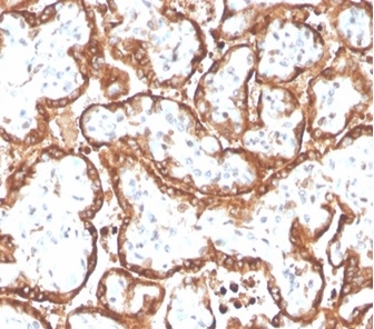 Formalin-fixed, paraffin-embedded human placenta stained with Chorionic Gonadotropin beta Chain (hCG beta) antibody (HCGb/4709R).