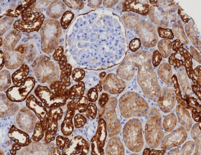 IHC analysis of formalin-fixed, paraffin-embedded human kidney. Negative tissue control using EpCAM/TROP1 antibody (EGP40/8130R) at 2ug/ml in PBS for 30min RT. HIER: Tris/EDTA, pH9.0, 45min. Secondary: HRP-polymer, 30min. DAB, 5min.