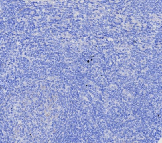 IHC analysis of formalin-fixed, paraffin-embedded human tonsil. Negative tissue control using EpCAM/TROP1 antibody (EGP40/8130R) at 2ug/ml in PBS for 30min RT. HIER: Tris/EDTA, pH9.0, 45min. Secondary: HRP-polymer, 30min. DAB, 5min.