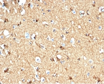 Formalin-fixed, paraffin-embedded human brain stained with Creatine Kinase BB antibody (CKBB/6565).