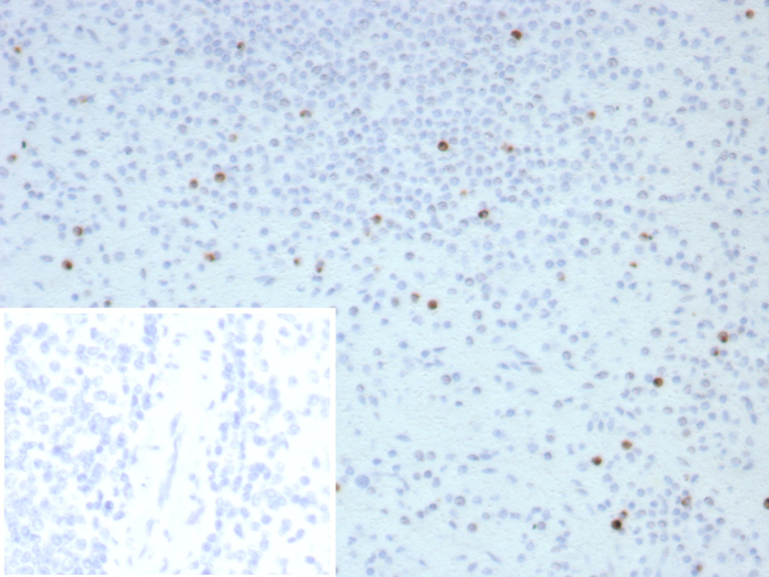 Formalin-fixed, paraffin-embedded human spleen stained with Perforin antibody (PRF1/8662R). Inset: PBS instead of primary antibody; secondary only negative control.