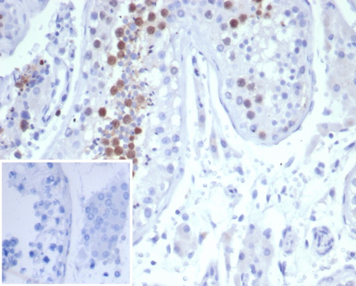 Formalin-fixed, paraffin-embedded human testis stained with KIF2C antibody (KIF2C/6522) at 2ug/ml. Inset: PBS instead of primary antibody; secondary only negative control.