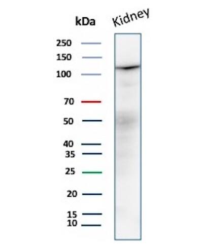 Western blot analysis of Human Kidney tissue lysate using MDM2/HDM2 Antibody (MDM2/7190R) - Azide and BSA Free.