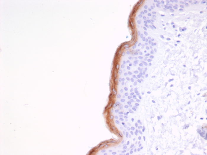 Formalin-fixed, paraffin-embedded human skin stained with Kallikrein 7 antibody (KLK7/4691). HIER: Tris/EDTA, pH9.0, 45min. Secondary: HRP-polymer, 30min. DAB, 5min.