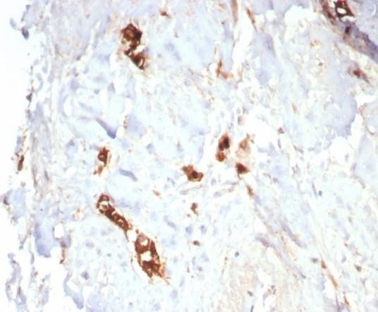 Formalin-fixed, paraffin-embedded human lactating breast stained with Mammaglobin A antibody (MGB/7980R). HIER: Tris/EDTA, pH9.0, 45min. Secondary: HRP-polymer, 30min. DAB, 5min.