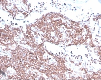 Formalin-fixed, paraffin-embedded human lymph node stained with MGMT antibody (MGMT/4791).