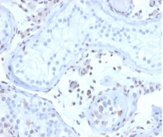 Formalin-fixed, paraffin-embedded human testis stained with MGMT antibody (MGMT/4791).
