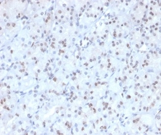 Formalin-fixed, paraffin-embedded human stomach stained with MGMT antibody (MGMT/4791).