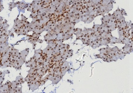 Formalin-fixed, paraffin-embedded human parotid gland stained with MGMT antibody (MGMT/8128R). HIER: Tris/EDTA, pH9.0, 45min. Secondary: HRP-polymer, 30min. DAB, 5min.