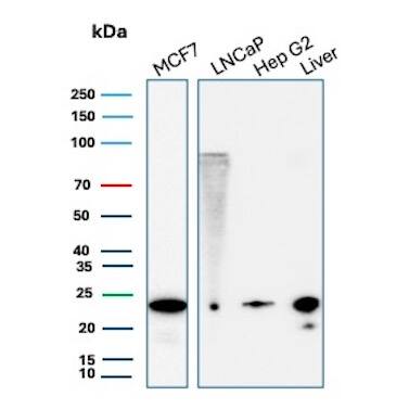 Western Blot Analysis of MCF-7, LNCaP, Hep G2 and  human liver lysates using MGMT Antibody (MGMT/8186R) - Azide and BSA Free.
