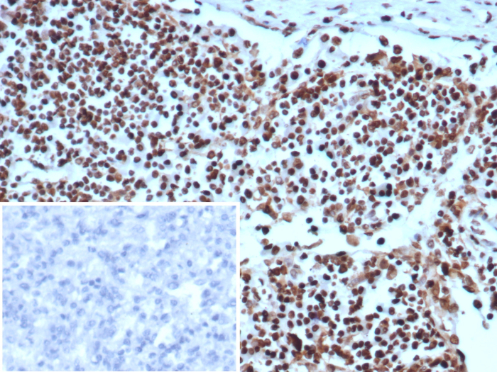 Formalin-fixed, paraffin-embedded human lymph node stained with Ku80/XRCC5 antibody (XRCC5/7314). Inset: PBS instead of primary antibody; secondary only negative control.