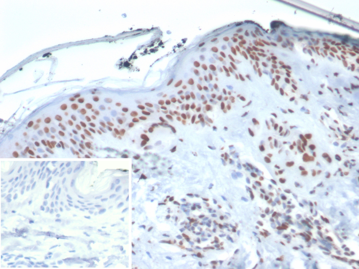 Formalin-fixed, paraffin-embedded human skin stained with Ku80/XRCC5 antibody (XRCC5/7314). Inset: PBS instead of primary antibody; secondary only negative control.