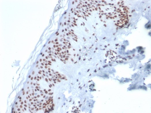 Formalin-fixed, paraffin-embedded human skin stained with Ku80/XRCC5 antibody (XRCC5/7316). HIER: Tris/EDTA, pH9.0, 45min. Secondary: HRP-polymer, 30min. DAB, 5min.