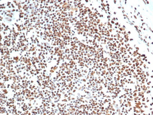 Formalin-fixed, paraffin-embedded human lymph node stained with Ku80/XRCC5 antibody (XRCC5/7316). HIER: Tris/EDTA, pH9.0, 45min. Secondary: HRP-polymer, 30min. DAB, 5min.