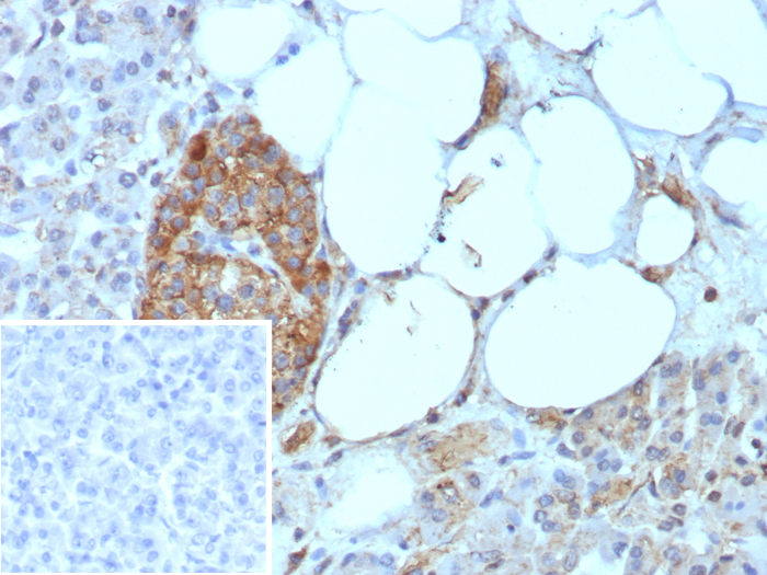 Formalin-fixed, paraffin-embedded human pancreas stained with CD99 antibody (rMIC2/8497). Inset: PBS instead of primary antibody; secondary only negative control.