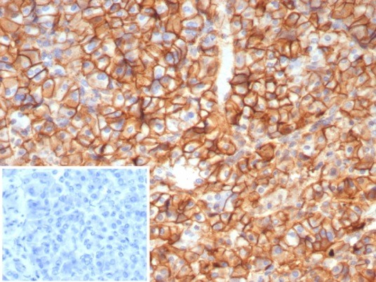 Formalin-fixed, paraffin-embedded human pancreas stained with CD99 antibody (MIC2/8119R). Inset: PBS instead of primary antibody; secondary only negative control.