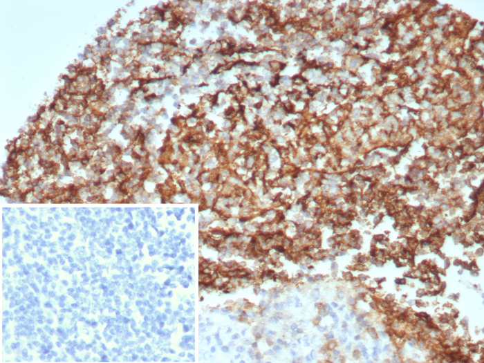 Formalin-fixed, paraffin-embedded human kidney stained with CD35 antibody (CR1/8674R) at 2ug/ml. Inset: PBS instead of primary antibody; secondary only negative control.