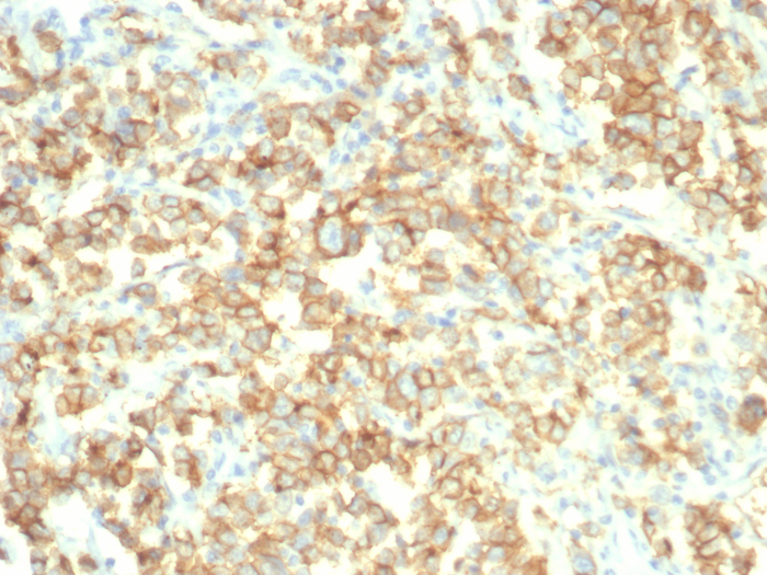 Formalin-fixed, paraffin-embedded human bladder stained with S100 calcium binding protein A14 antibody (S100A14/7403). HIER: Tris/EDTA, pH9.0, 45min. Secondary: HRP-polymer, 30min. DAB, 5min.