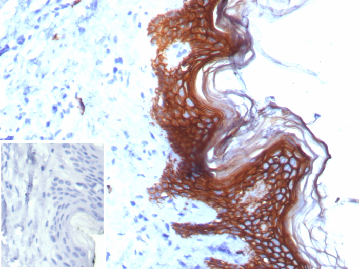 Formalin-fixed, paraffin-embedded human skin stained with S100 calcium binding protein A14 antibody (S100A14/7403). Inset: PBS instead of primary antibody; secondary only negative control.