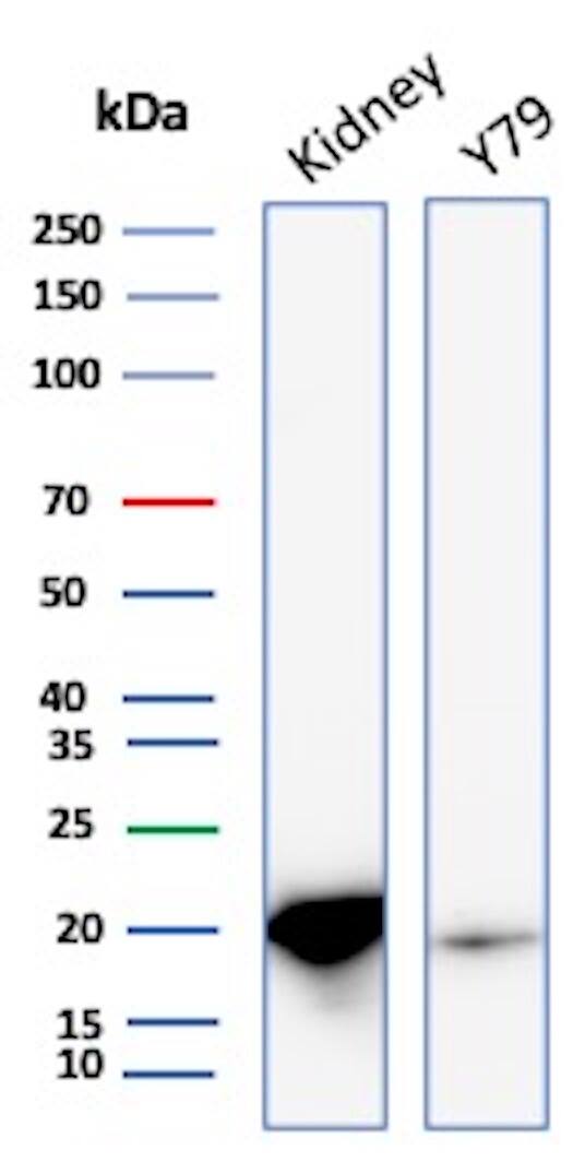 Western blot analysis of Human Kidney and Y79 lysates using AlphaB Crystallin/CRYAB Antibody (CRYAB/4661) - Azide and BSA Free. 