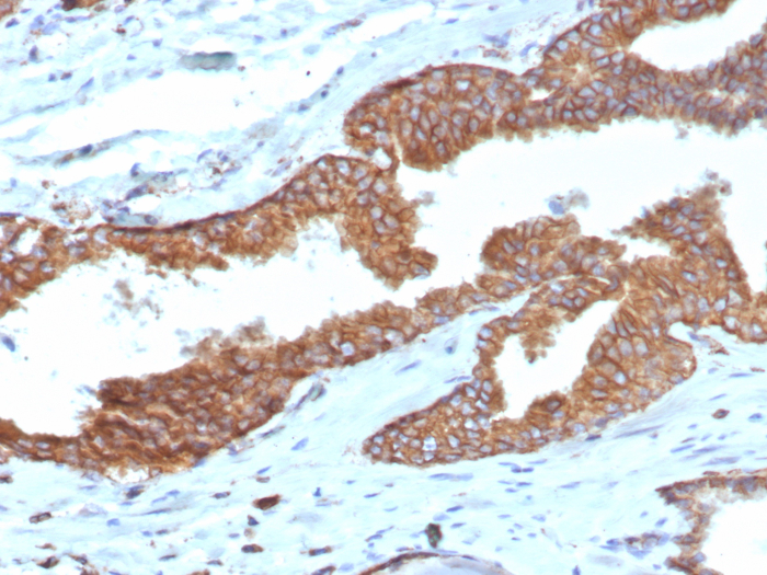 Formalin-fixed, paraffin-embedded human prostate stained with COX-2 antibody (COX2/7803R). HIER: Tris/EDTA, pH9.0, 45min. Secondary: HRP-polymer, 30min. DAB, 5min.