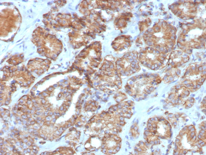 Formalin-fixed, paraffin-embedded human prostate stained with COX-2 antibody (COX2/7803R). HIER: Tris/EDTA, pH9.0, 45min. Secondary: HRP-polymer, 30min. DAB, 5min.