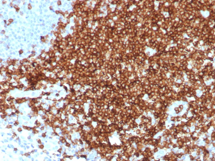 Formalin-fixed, paraffin-embedded human tonsil stained with CD7 antibody (CD7/8496R). HIER: Tris/EDTA, pH9.0, 45min. Secondary: HRP-polymer, 30min. DAB, 5min.