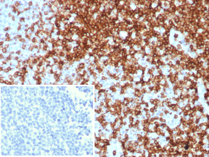 Formalin-fixed, paraffin-embedded human tonsil stained with CD7 antibody (CD7/8496R). Inset: PBS instead of primary antibody; secondary only negative control.