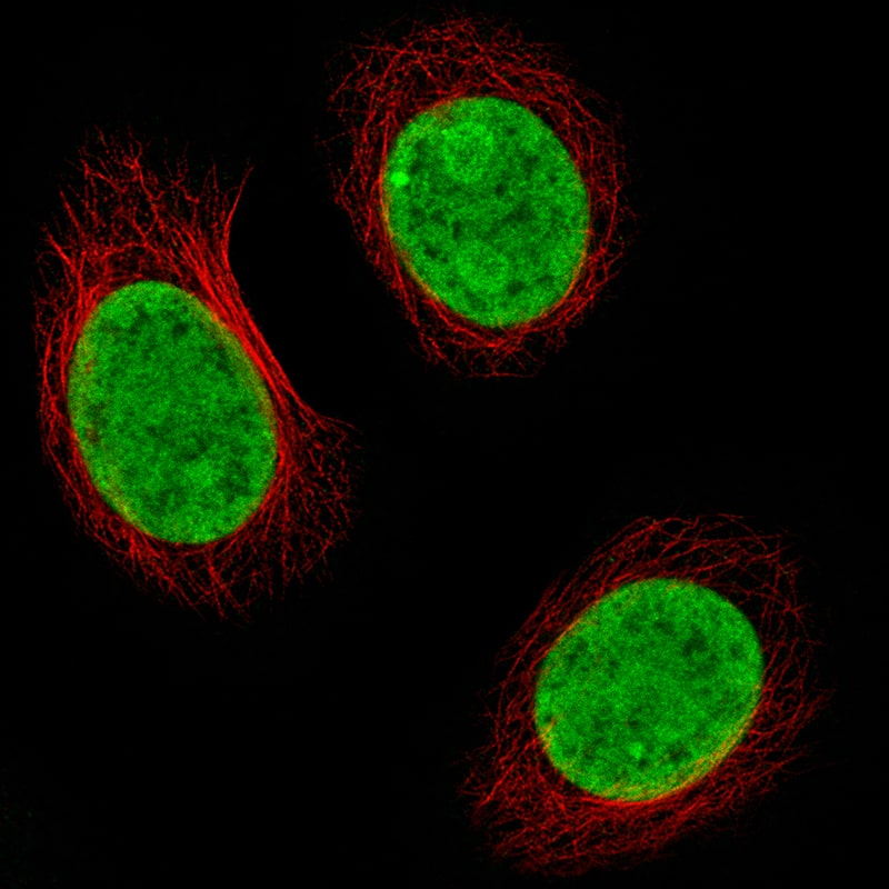 Staining of MCF7 cells, showing specific staining in nucleoplasm and nucleoli in green. Microtubule- and nuclear probes are visualized in red and blue, respectively (where available).