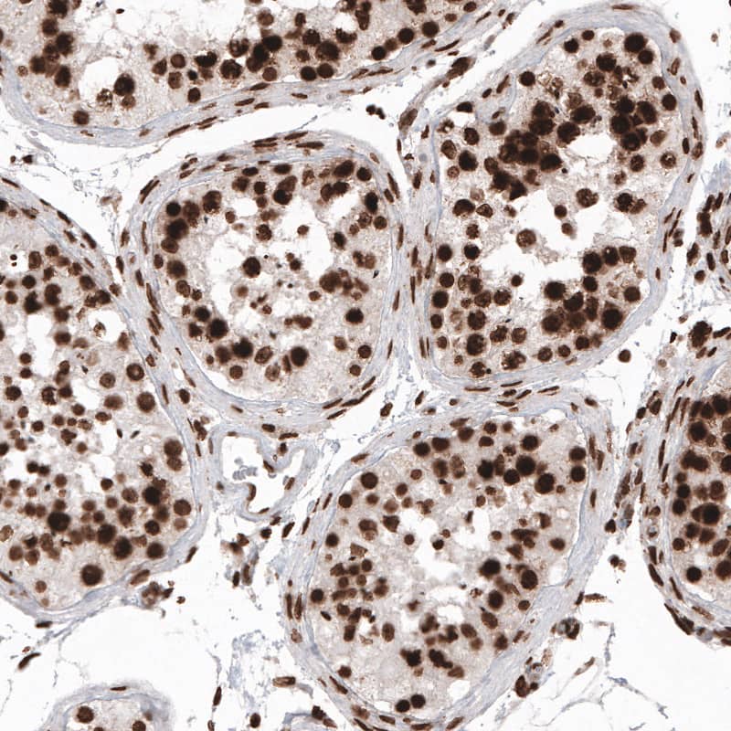 Staining of human testis shows strong nuclear positivity in cells in seminiferous tubules.