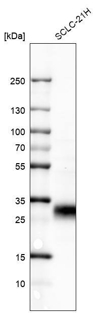 Analysis in human cell line SCLC-21H.