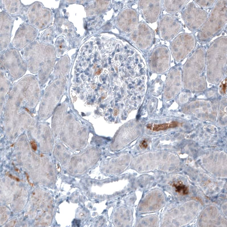 Staining of human kidney shows moderate positivity in secretion.