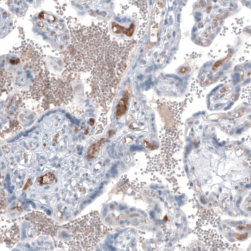 Staining of human placenta shows moderate positivity in secretion.