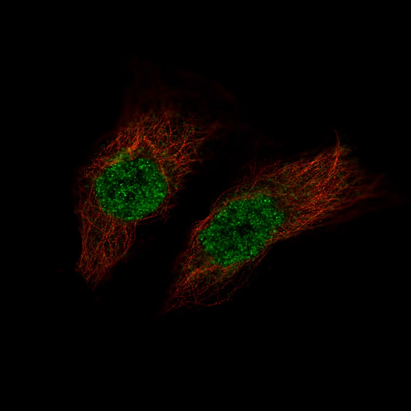 Staining of EFO-21 cells, showing specific staining in the nucleoplasm in green. Microtubule- and nuclear probes are visualized in red and blue, respectively (where available).
