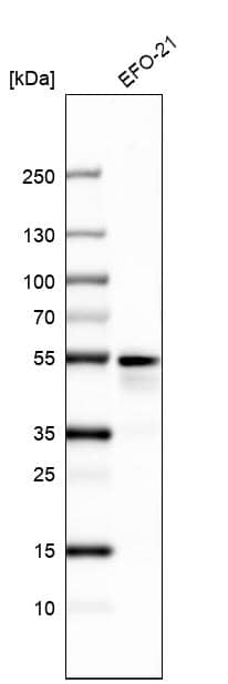 Analysis in human cell line EFO-21.