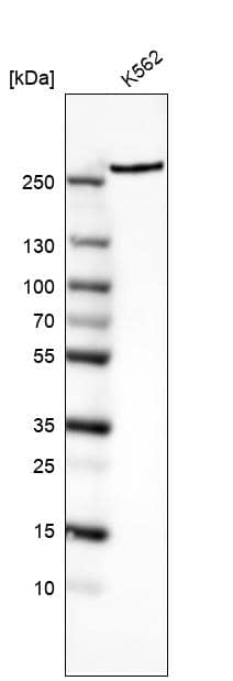 Analysis in human cell line K562.