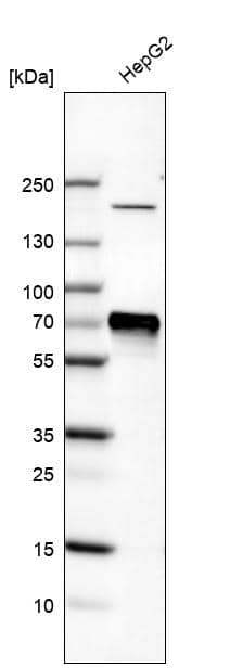 Analysis in human cell line HepG2.