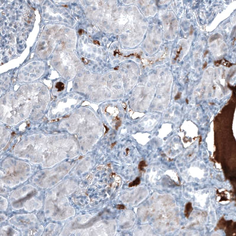 Staining of human kidney shows moderate positivity in secretion.