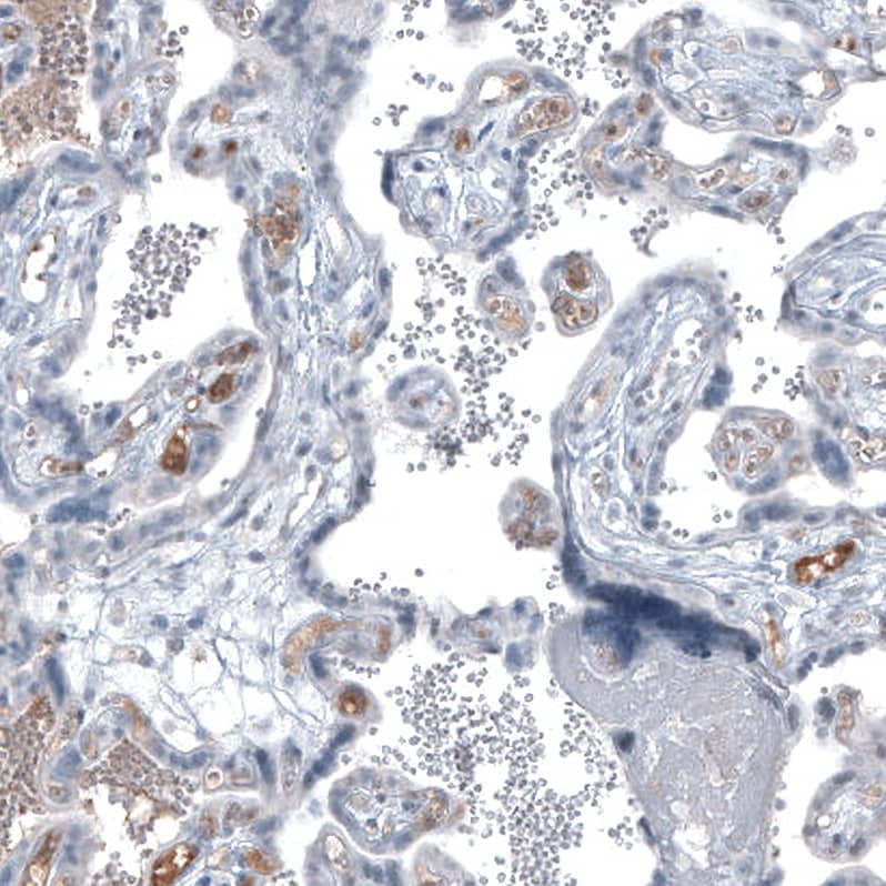 Staining of human placenta shows moderate positivity in secretion.