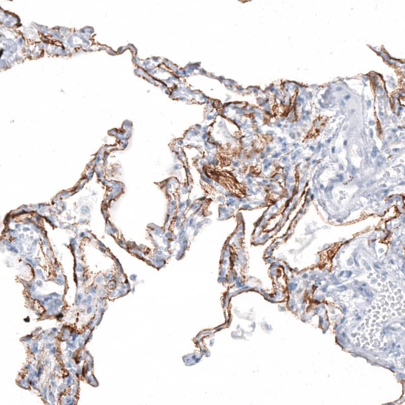 Staining of human lung shows strong membranous positivity in pneumocytes.