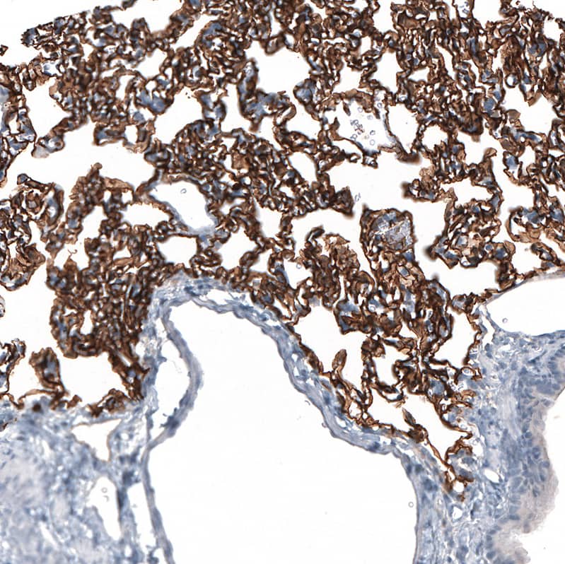 Staining of rat lung shows strong membranous positivity in pneumocytes.