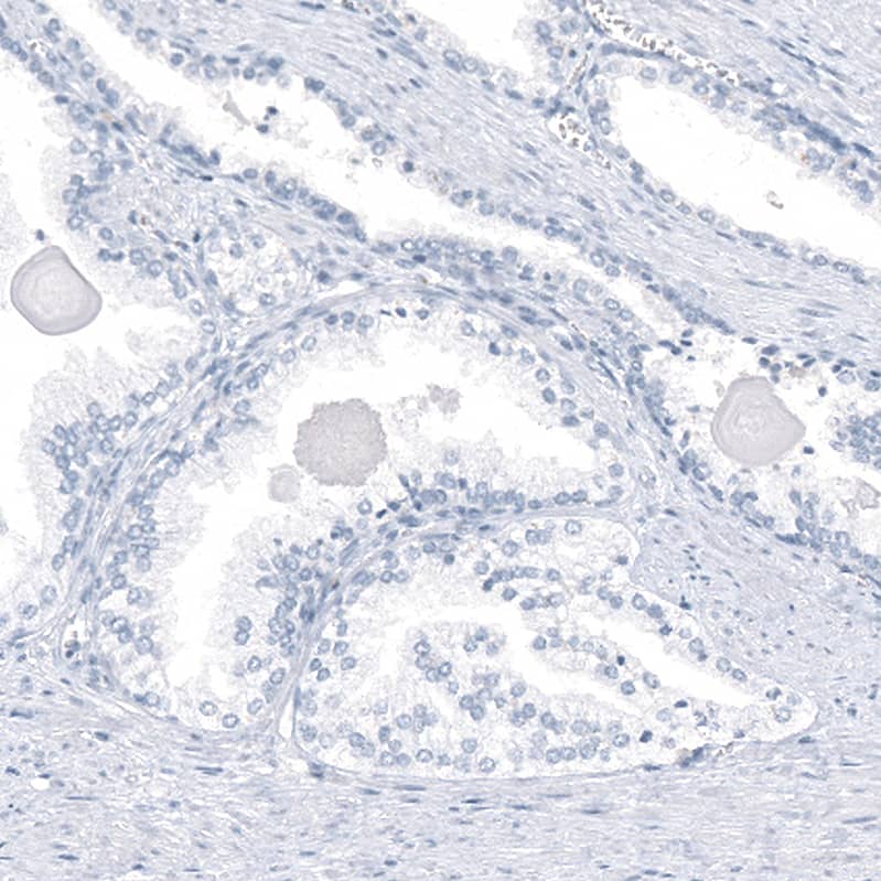 Staining of human prostate shows no positivity in glandular cells as expected.