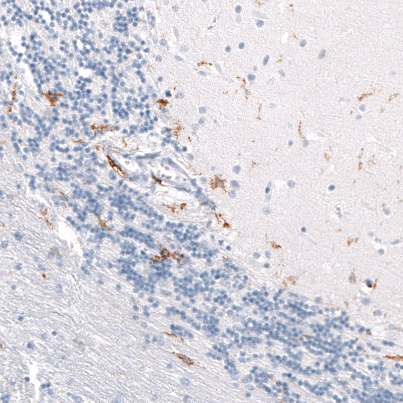 Staining of human cerebellum shows moderate cytoplasmic positivity in microglia.