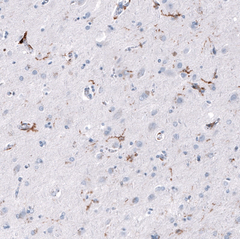 Staining of human cerebral cortex shows strong cytoplasmic positivity in perivascular macrophages as well as moderate positivity in microglia.